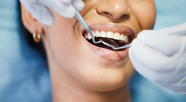Best Emergency Treatment for Oral Infections in Des Plaines, IL